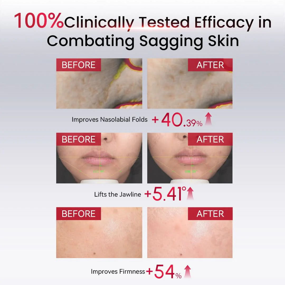 AMIRO PDRN Firm Radiance Boosting Serum | 90-Day Refill - Image 5