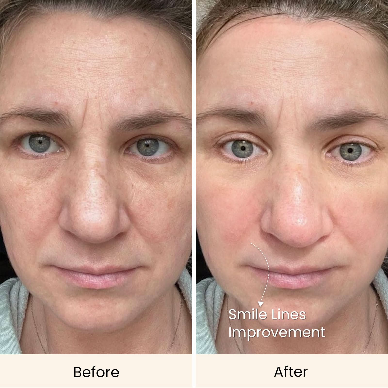 [Ultimate Saving] Spectra & Micro-Infusion for Just $309.99 - Image 10