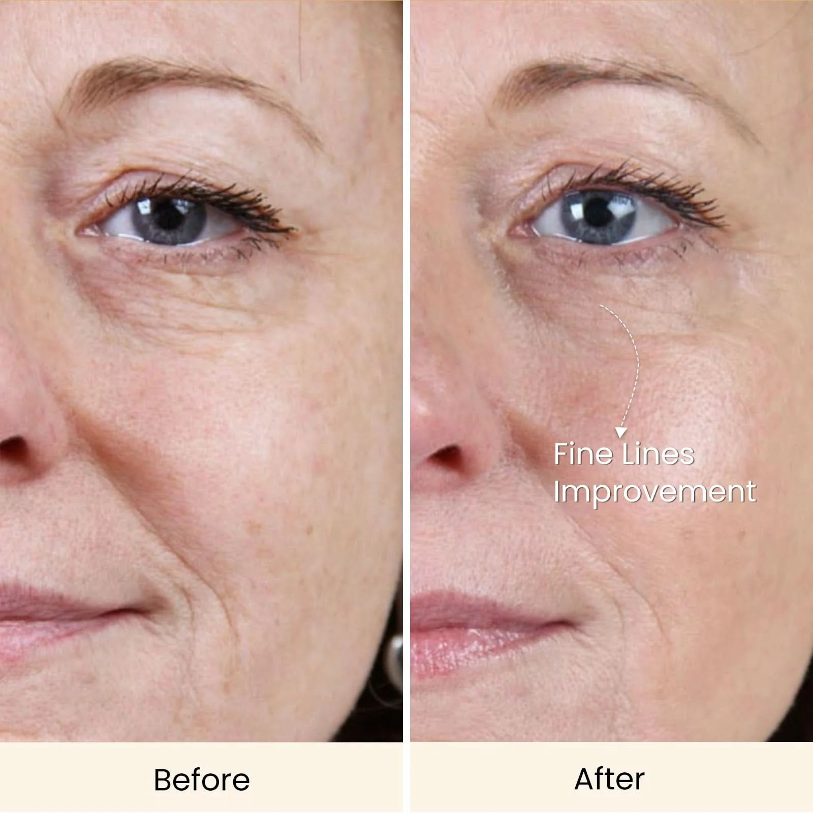 [Ultimate Saving] Spectra & Micro-Infusion for Just $309.99 - Image 11